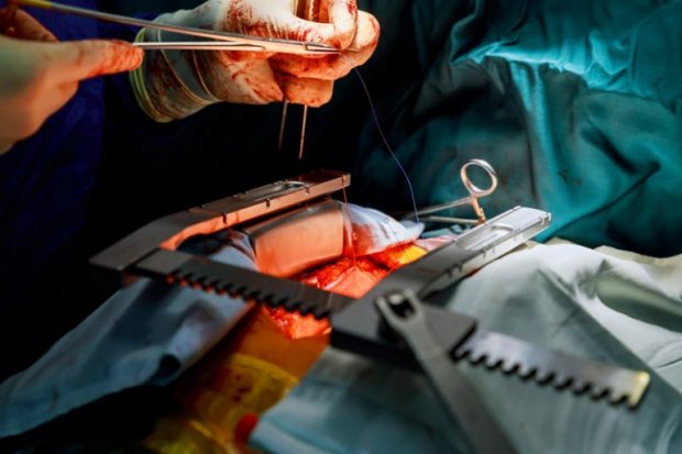 MAIS DE 30 MILHÕES DE HABITANTES ATENDIDOS  POR 100 CARDIOLOGISTAS NO PAÍS