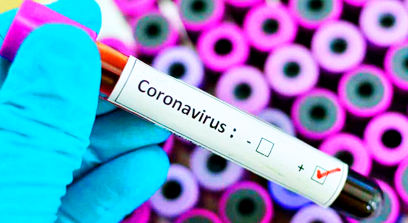 Covid-19:Vinte e um angolanos com testes inconclusivos